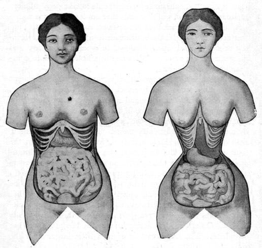 20 Bones, Broken Ribs, and Other Myths about Corset Waist Training